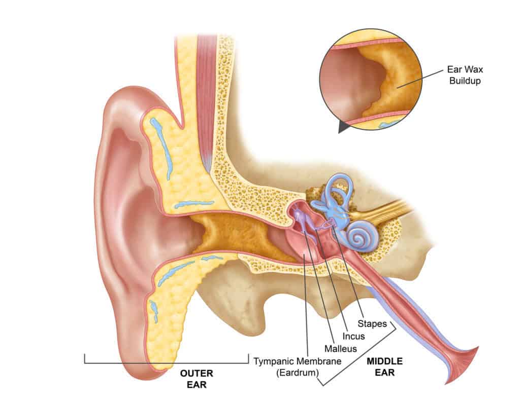 Ear Wax